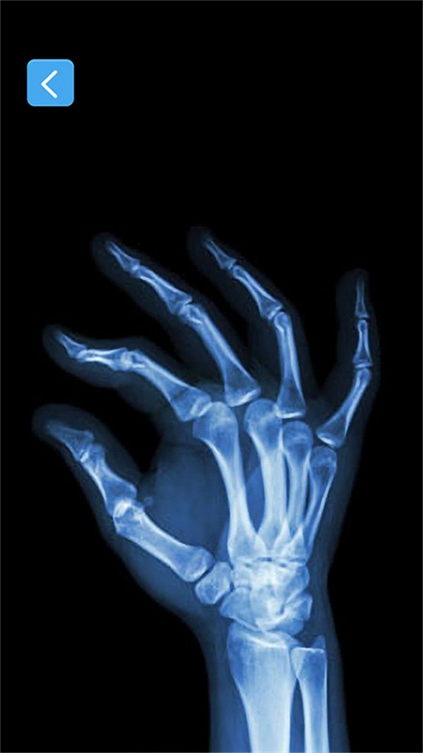 X射线模拟器图1